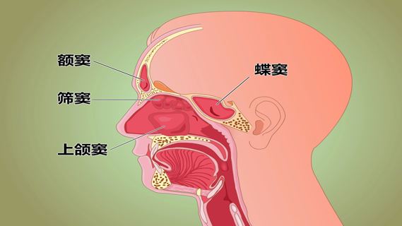 成都鼻窦炎患儿有哪些护理？