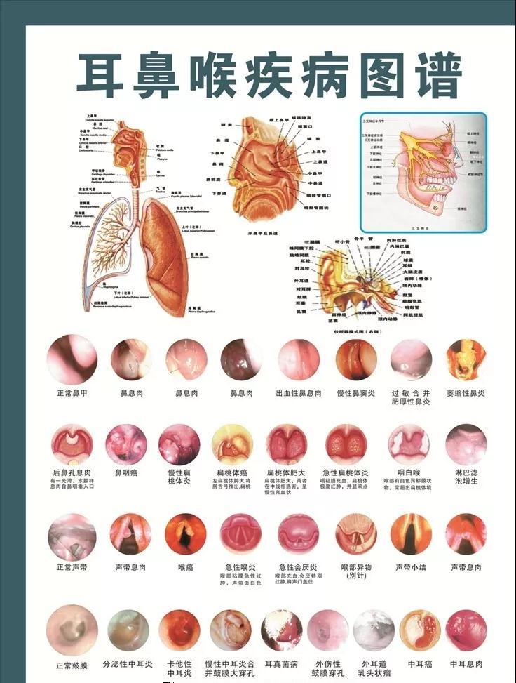 耳鼻喉疾病图谱