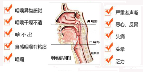 咽喉炎