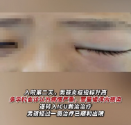 鼻子和耳朵清洁过度，小心健康反击！