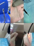 <b>成都仁品医院的医生巧手取鱼刺，“24小时取鱼刺门诊”频频获赞！</b>
