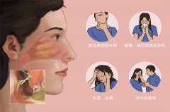 萎缩性鼻炎的病因是什么,如何治疗-成都仁品耳鼻喉医院提示